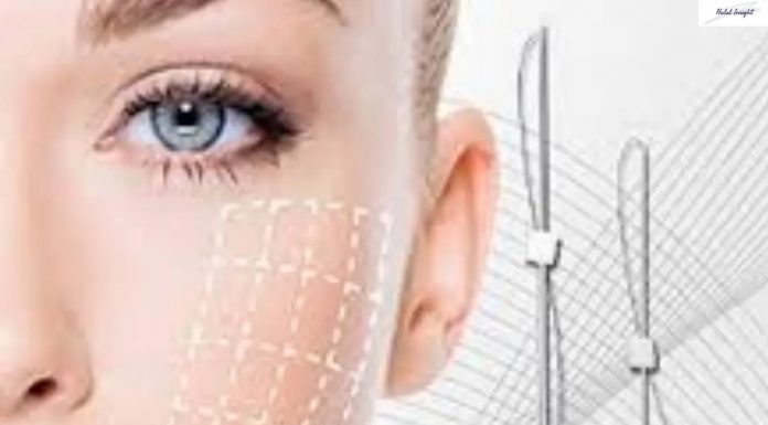 Thread Lift / Tanam Benang